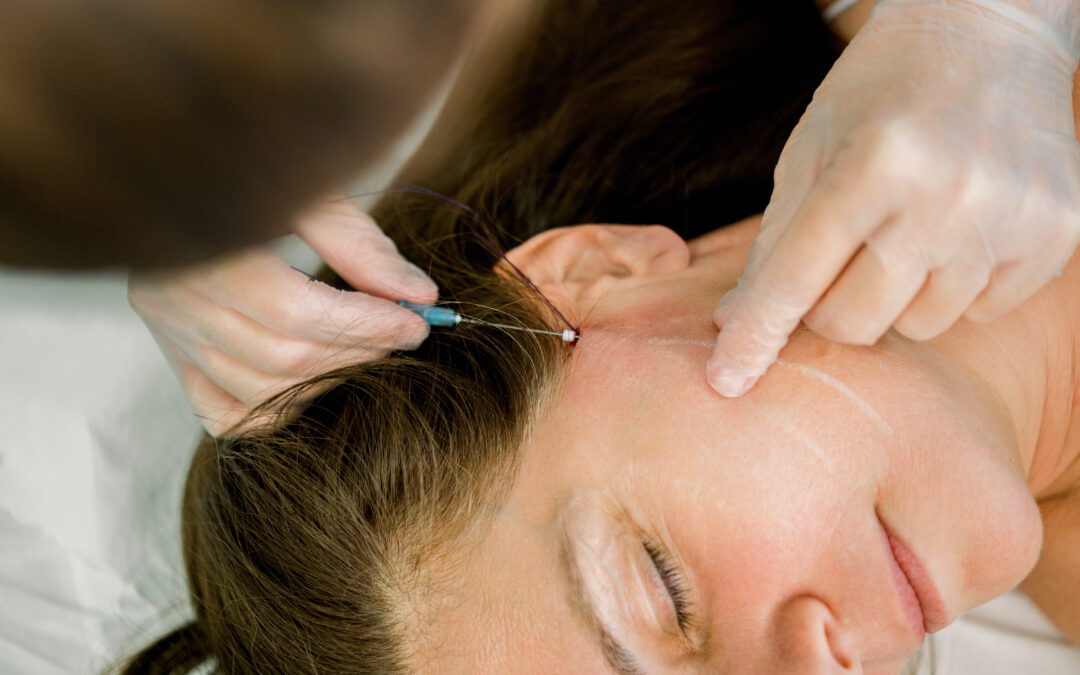 Areas of the Face That Can Be Enhanced with Juvederm®